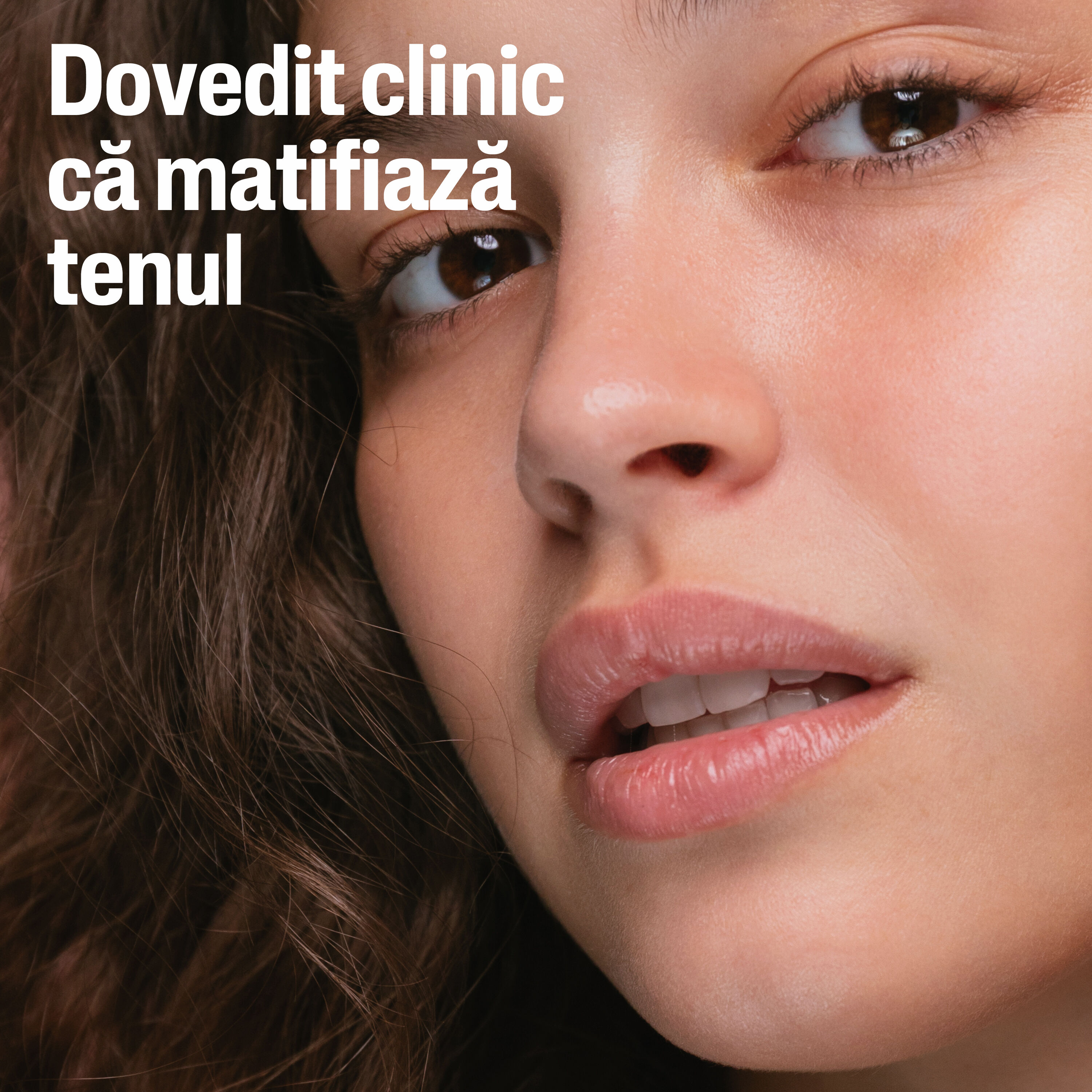 Pro SpotControl Loțiune Hidratantă SPF 30